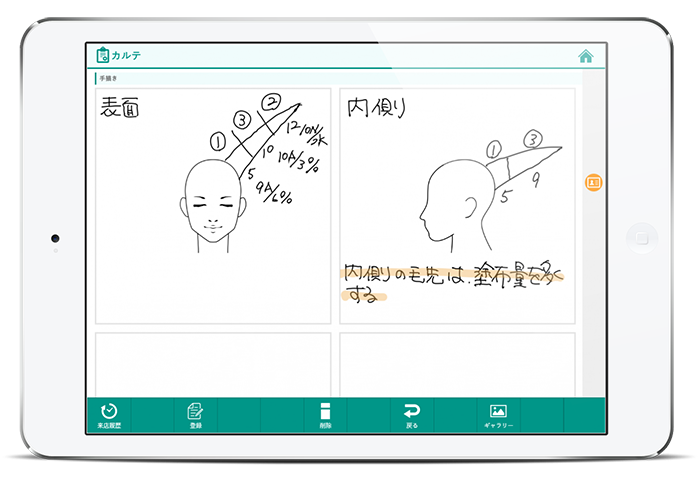 美容版では、正面・後方、右・左の4方向のイラストをご用意。施術の詳細を手描きで記録可能です。