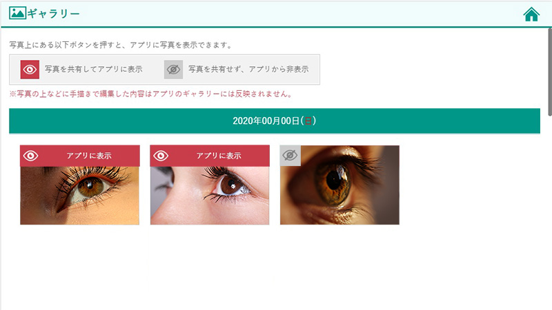 電子カルテで撮影・保存した写真をアプリ上でお客様と共有可能です。